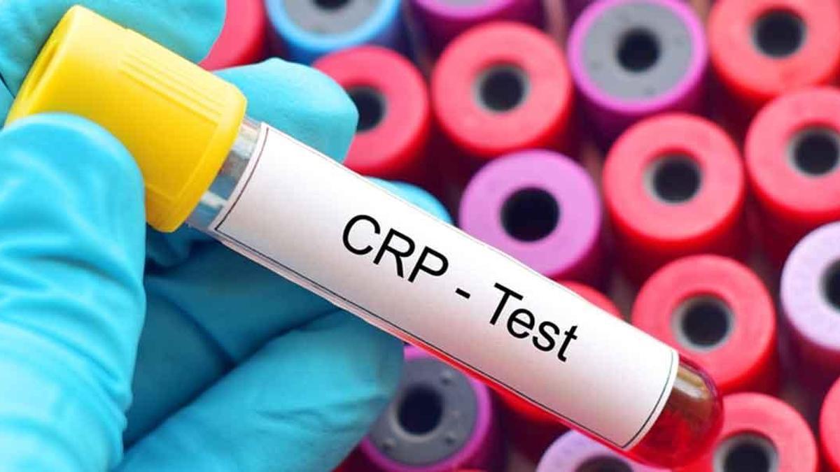 Crp Nedir, Hangi Durumlarda Yükselir? Antibiyotikle Düşmeyen Crp Nasıl Düşürülür?