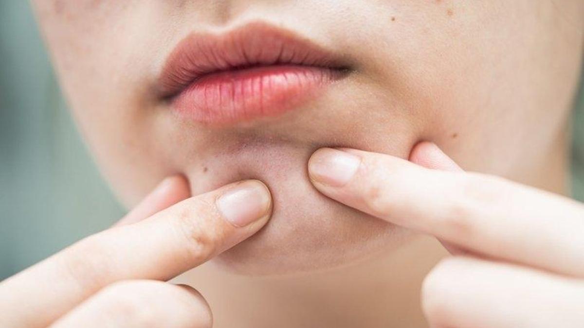Yağ Bezesi İçin Hangi Doktora Gidilir? Yağ Bezelerine Hangi Bölüm Bakar?