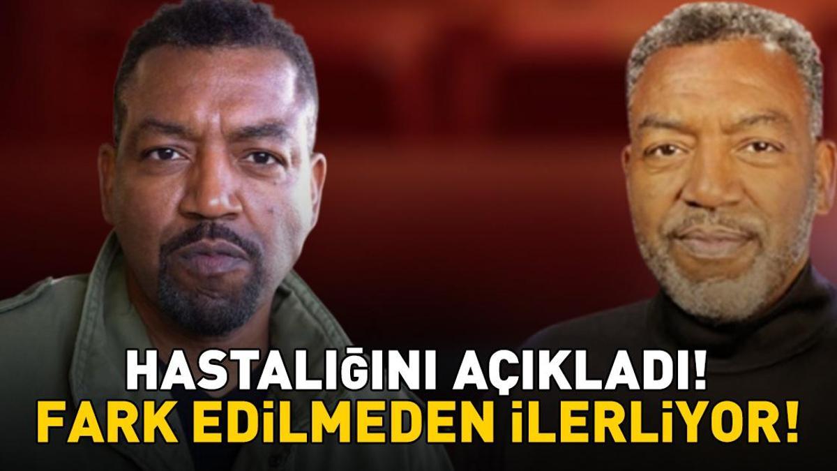 Grey’s Anatomy'nin Yıldızı Russell Andrews Hastalığını Açıkladı! Bu Belirtilere Dikkat! Fark Edilmeden İlerliyor!