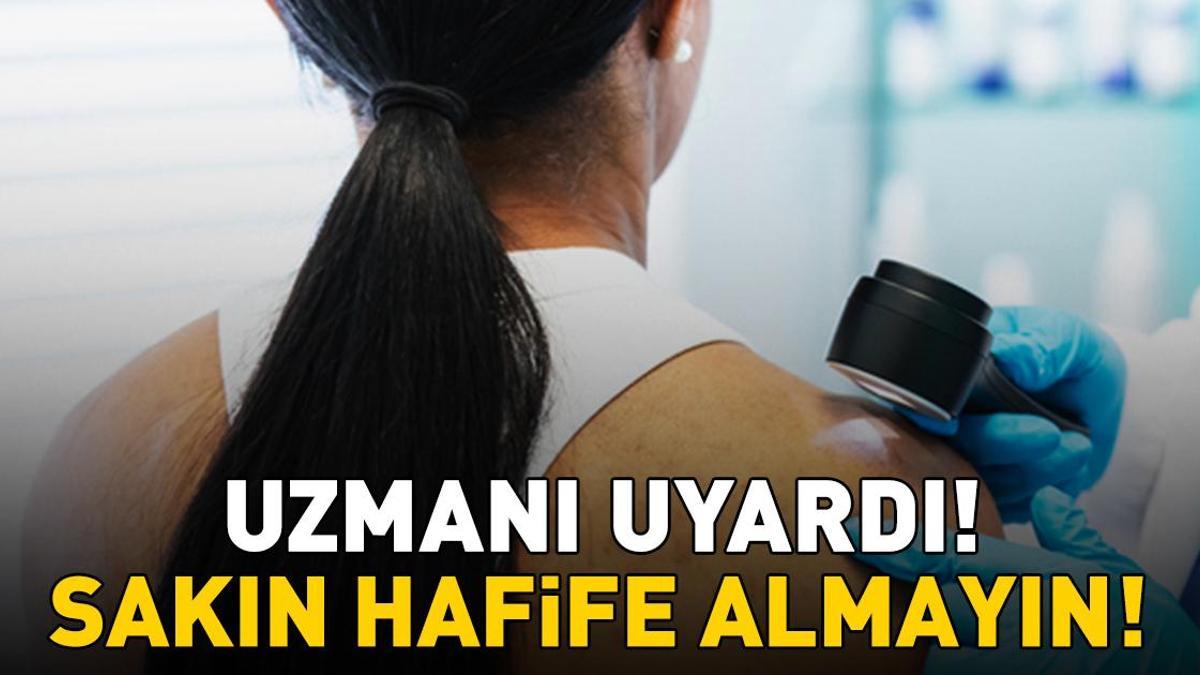 Erken teşhis önemli! Uzman isim uyardı: ‘Cildinizdeki değişimleri hafife almayın’