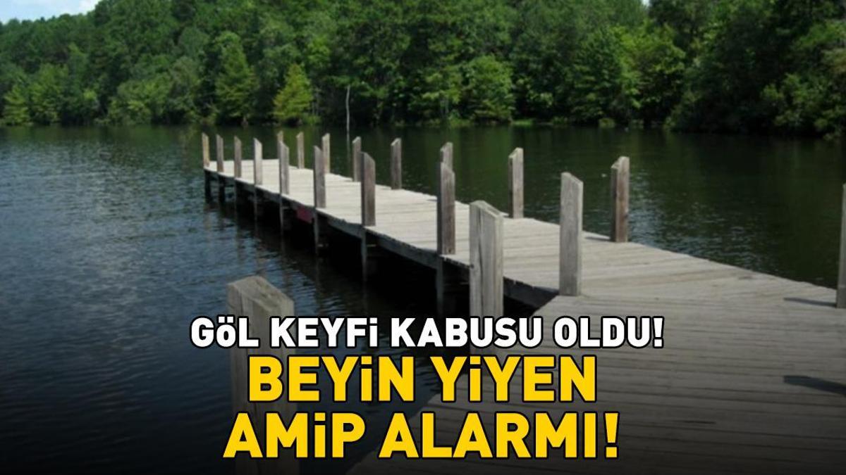 Göl keyfi kabusu oldu! 'Beyin yiyen amip' alarmı!