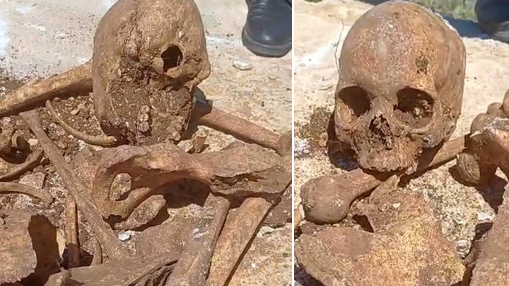 Malatya'da temel kazısında insan kemikleri ile kafatası parçası bulundu