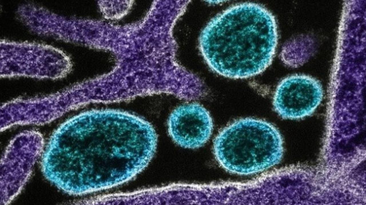 ABD'de 60 yıl sonra bir hayvanda et yiyen parazit görüldü