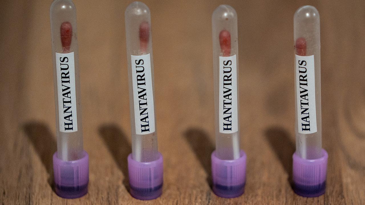 ABC: ABD, hantavirüs vakalarını 3. seviye acil durum koduyla takibe aldı