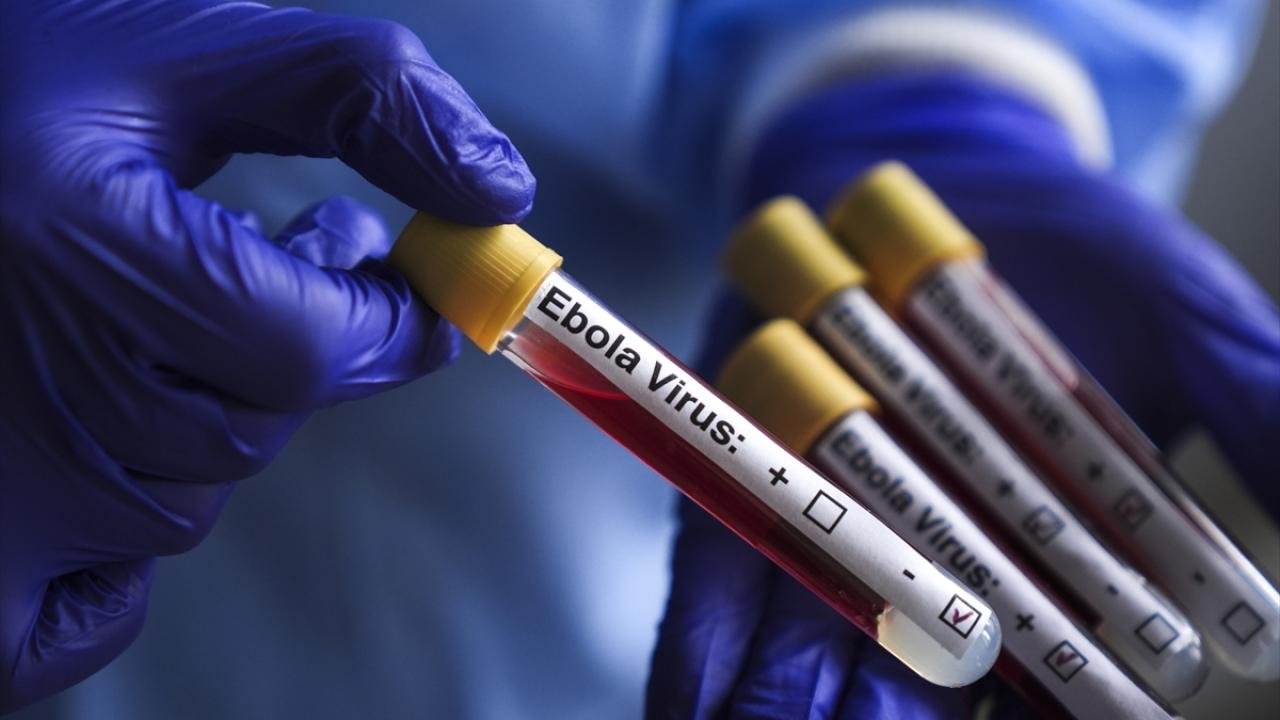 Fransa'da Ebola vakası görüldü